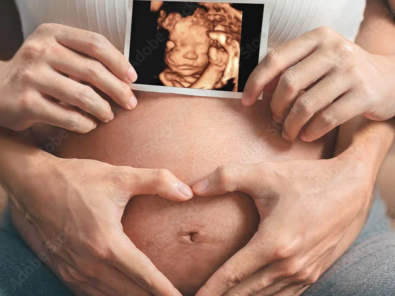 A person holding an image of a baby in the belly.