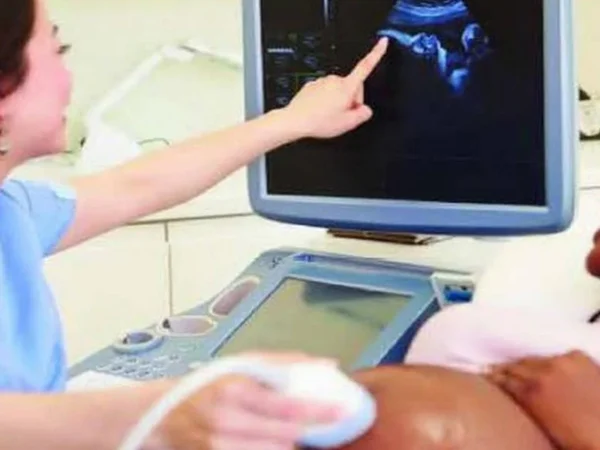 A person pointing to an image on the screen of a computer.